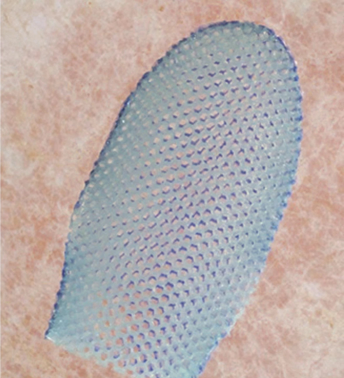 Supracor Stimulite Honeycomb Dual-Sided Softer/Firmer Bath Mitt